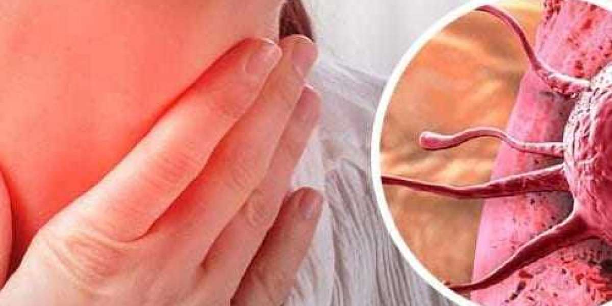 Lenf Kanseri Olanların Yorumları? Lenfoma Olduğunuzu Nasıl Anladınız?