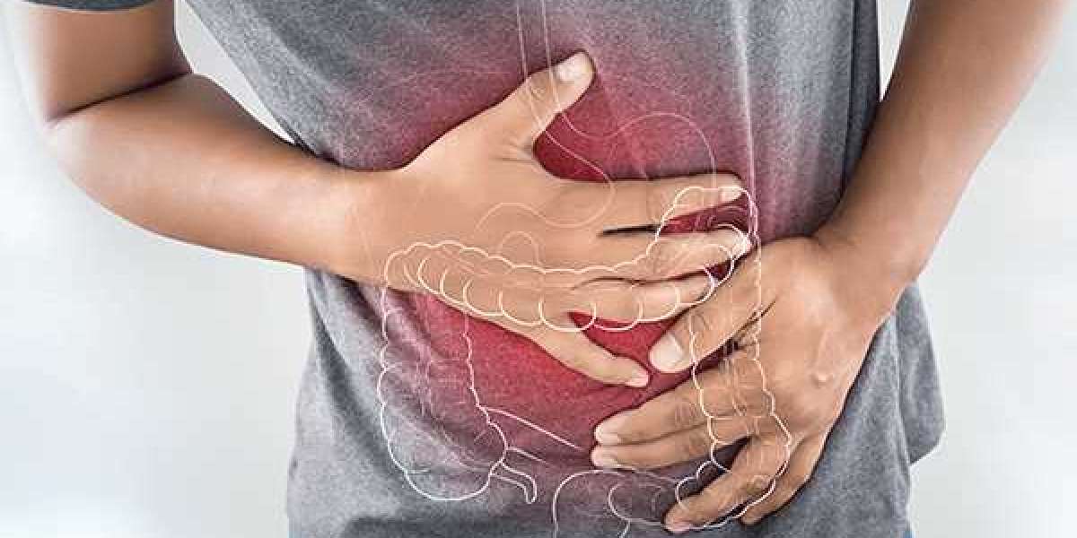 Mesane Kanseri Nedir Belirtileri Nelerdir? Mesane Kanseri Tedavisi?