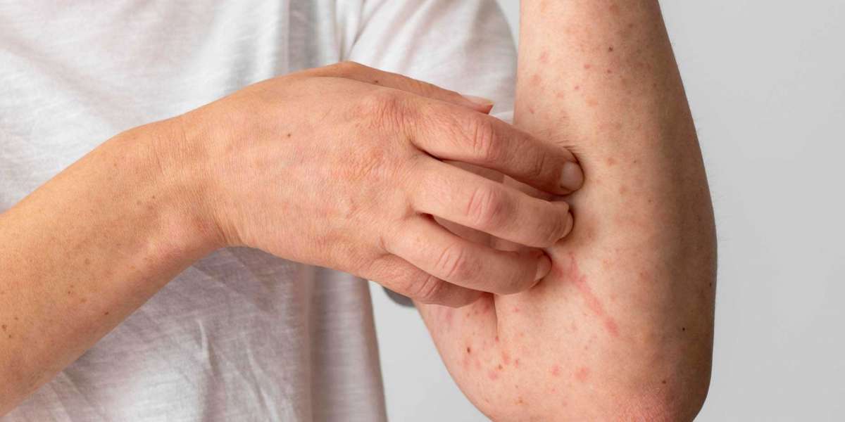 Dermatoloji Hangi Hastalıklara Bakar? Dermatoloji Bölümü Nedir?