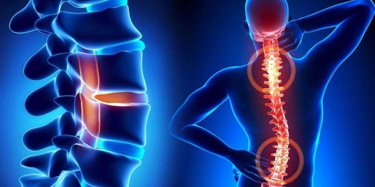 Sırt Kaburga Ağrısı Hangi Bölüm Bakar? Kaburga Ağrısı Doktor?