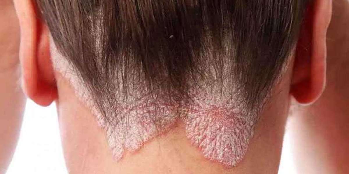 Dermatolog ve Cildiye Arasındaki Fark? Dermatolog Cildiye Aynı mı?