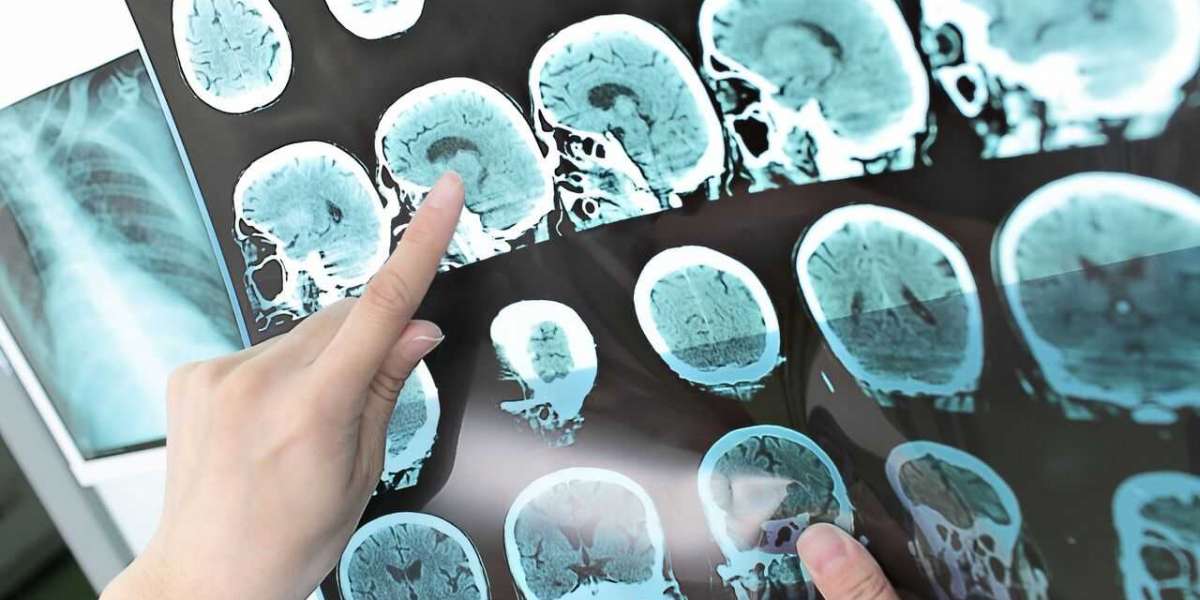 Emes Hastalığı Nedir Belirtileri? Emes Hastalığı Tedavisi Nedir?